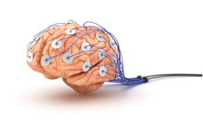 Brain w Electrodes.png